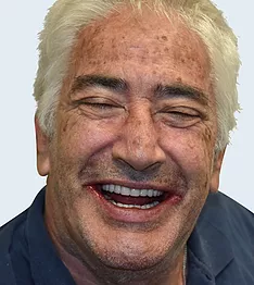 dale-after