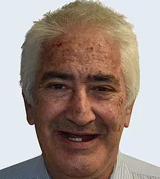 dale-before