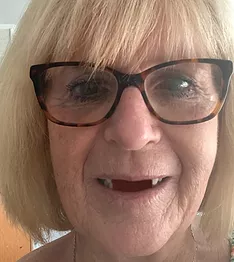 linda-before