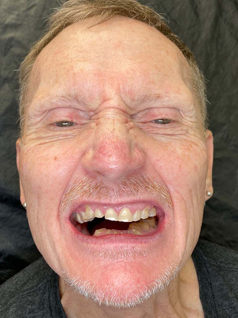 Bill-before
