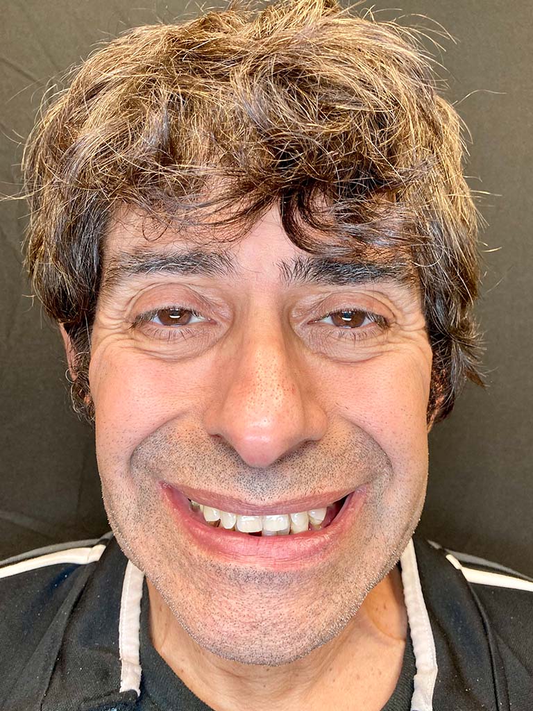 Hector-before