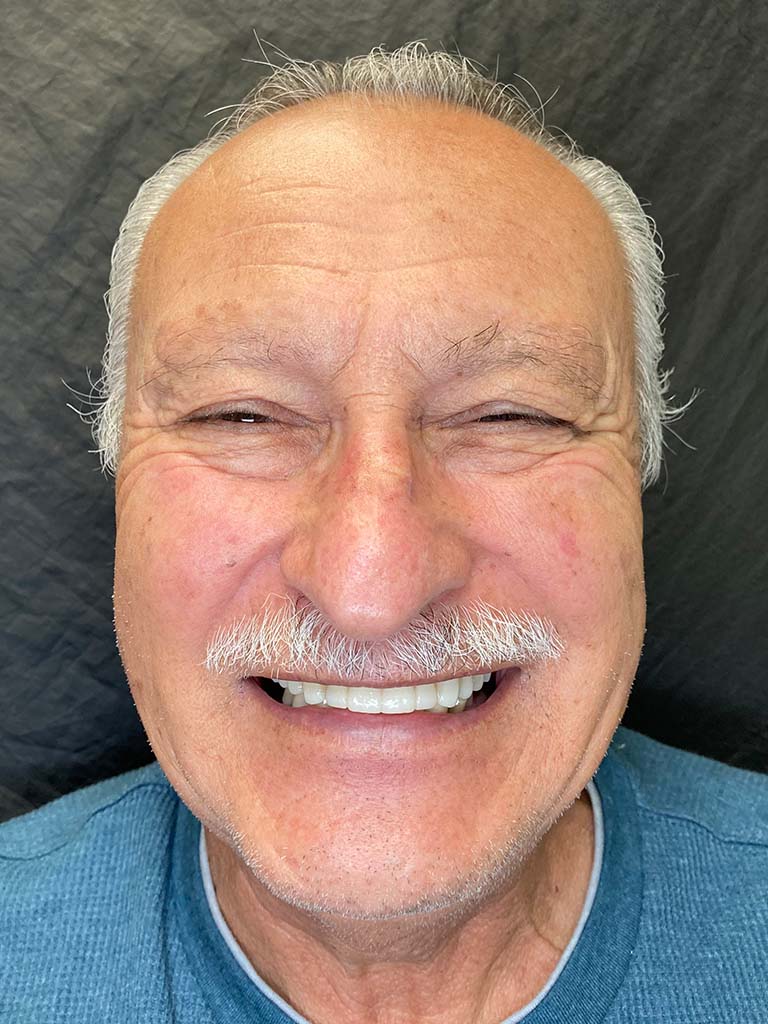 Juan-after