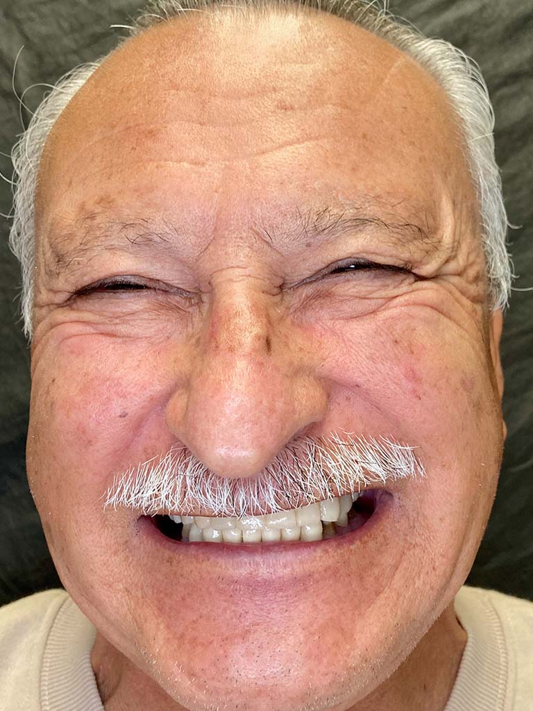 Juan-before